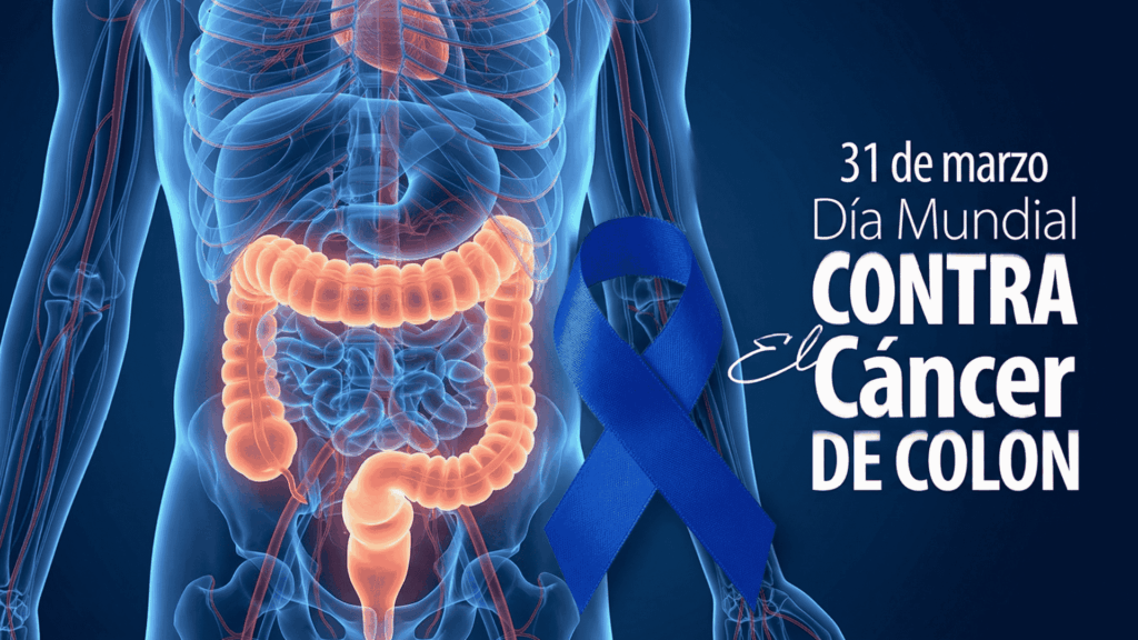 Cáncer de colon silencioso, frecuente y prevenible